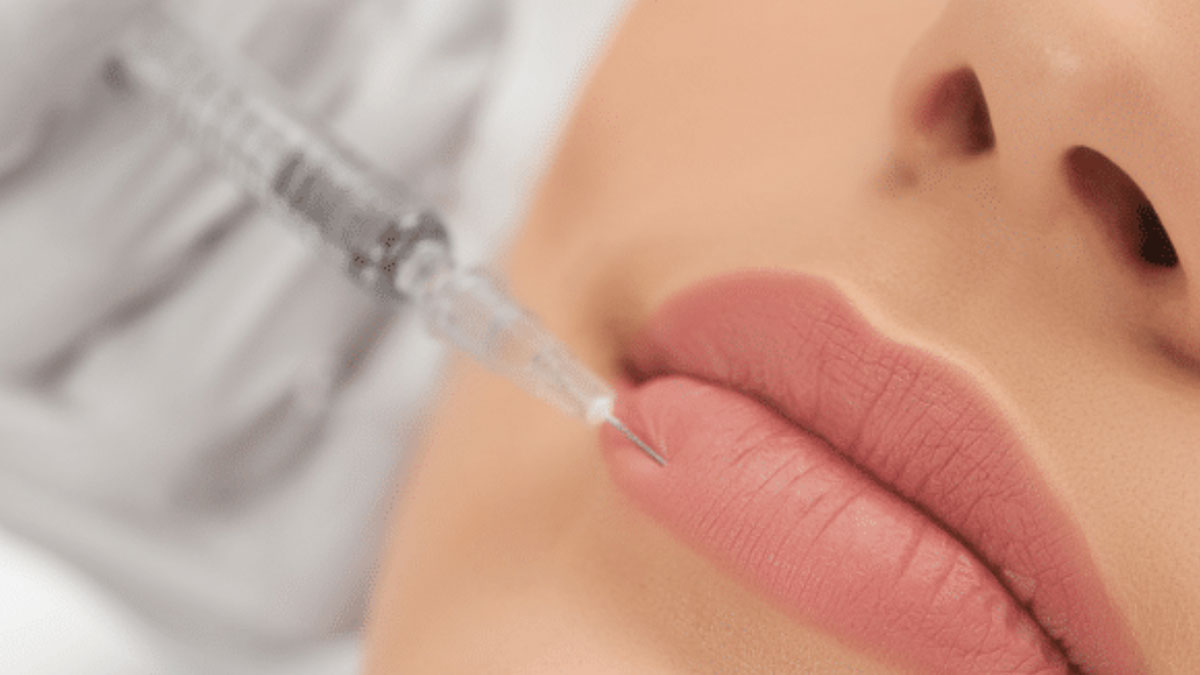 فیلر لب اصفهان| هزینه تزریق ژل لب در کلینیک دکتر حداد