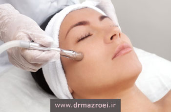 میکرودرم ابریژن برای لک صورت؛ مزایا، نحوه انجام و نتایج