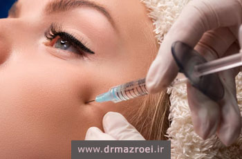 مراقبت های بعد از تزریق مزوژل برای دستیابی به بهترین نتیجه