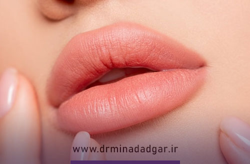 مهمترین مراقبت های بعد از تزریق ژل لب که باید بدانید