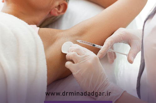 عوارض بوتاکس زیر بغل؛ واقعیت یا شایعه رایج؟