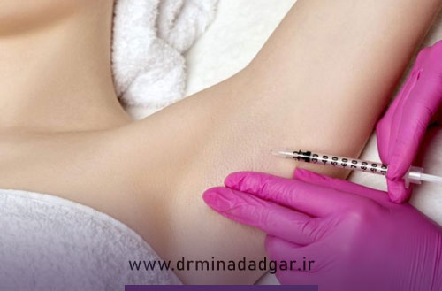 مراقبت های بعد از بوتاکس زیر بغل؛ راهنمای کامل
