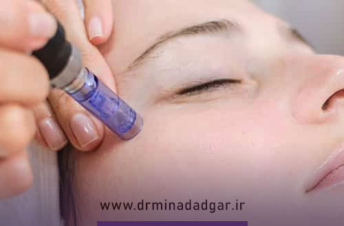 عوارض میکرونیدلینگ و بهترین راه های کاهش آنها