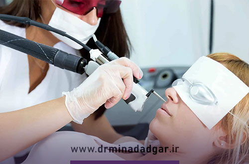 لیزر موهای زائد صورت؛ راهنمای کامل برای آقایان و بانوان