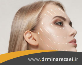 لیفت با نخ چقدر دوام دارد؟