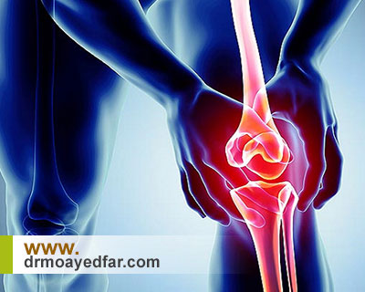 علائم استئوآرتریت یا آرتروز زانو را بشناسید