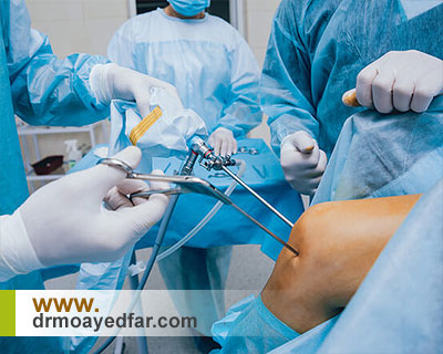آنچه بهتر است درباره جراح زانو بدانیم