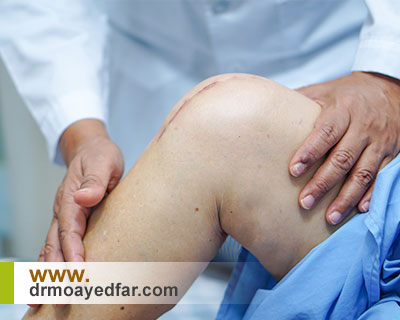 قبل از جراحی زانو چه اقداماتی لازم است؟