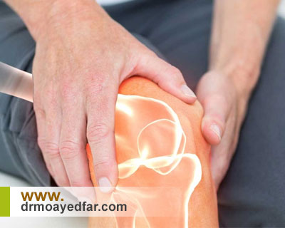 عوارض عدم جراحی زانو در مبتلایان به ساییدگی مفصل زانو