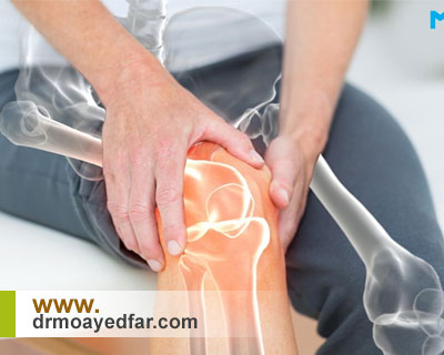 در چه افرادی تعویض مجدد مفصل زانو ضروری است؟