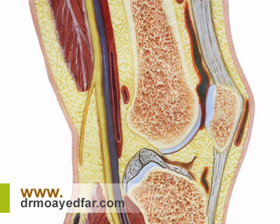 سینووکتومی چیست و چگونه انجام میشود؟