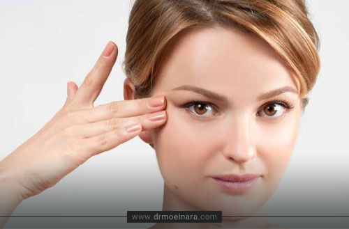 لیفت شقیقه؛ روش ها، مزایا، ماندگاری و هزینه