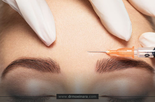 بوتاکس چیست و چرا تزریق بوتاکس انجام می شود؟