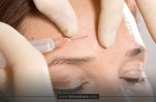 عوارض بوتاکس چیست و چه زمانی خطرناک می شود؟