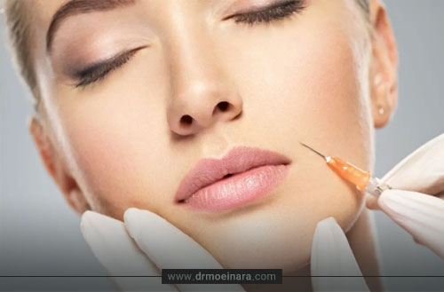 تزریق بوتاکس خط لبخند؛ رفع چین و چروک های اطراف لب
