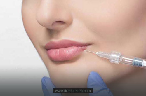 تزریق ژل به لب؛ انواع، مزایا، مراقبت ها و هزینه