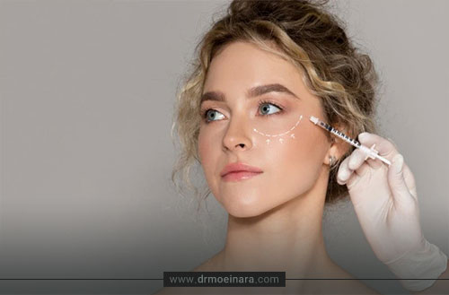 تزریق مزوژل زیر چشم؛ روش تزریق، ماندگاری و عوارض + قیمت مزوژل زیر چشم