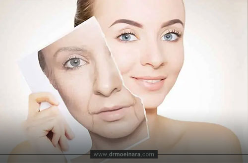 ماندگاری مزوژل؛ از عوامل موثر تا روش های افزایش ماندگاری