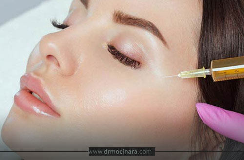 پی آر پی صورت؛ آشنایی با کاربردها و هزینه prp صورت در سال 1404