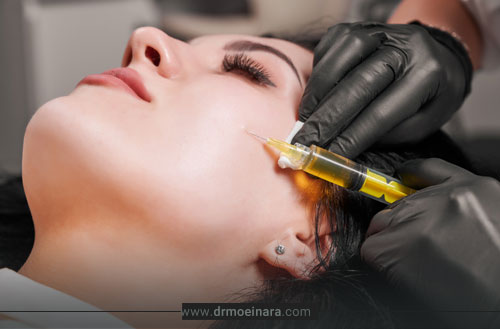 عوارض پی آر پی صورت؛ هرآنچه باید قبل از تزریق بدانید