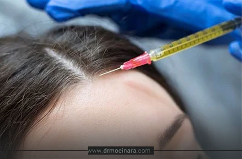 مراقبت های بعد از پی آر پی مو؛ نکات مهم افزایش اثر درمان و جلوگیری از ریزش