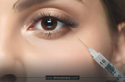 مزوژل جالپرو زیر چشم؛ روش و نقاط تزریق + تاثیر مزوژل جالپرو زیر چشم