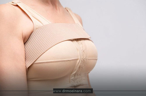 سوتین طبی بعد از عمل ماموپلاستی؛ مدت زمان استفاده و معرفی بهترین مارک