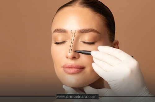 عمل بینی گوشتی؛ بررسی نتیجه، هزینه + بهترین سن برای عمل بینی گوشتی