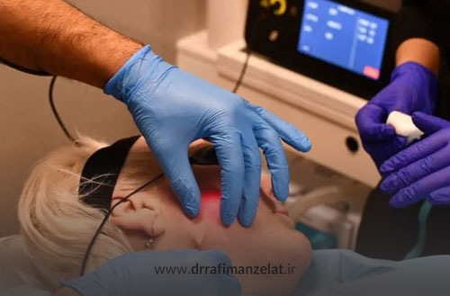 اندولیفت صورت؛ روشی غیر جراحی برای جوانسازی و سفت کردن پوست