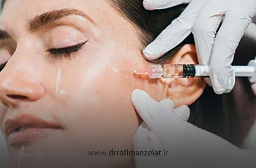 ماندگاری ژل پروفایلو؛ عوامل موثر و روش های افزایش دوام