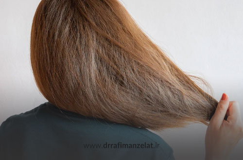 موخوره گرفتن مو؛ دلایل، نشانه ها و روش های جلوگیری