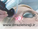کاربرد و مزایای درمان مشکلات پوستی با لیزر اربیوم