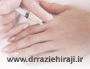درمان پیری و رفع چروک های دست با تزریق چربی