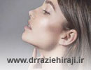 روش های زاویه سازی و فرم دهی فک بدون جراحی