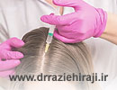 تزریق مزوتراپی جهت جلوگیری از ریزش موها