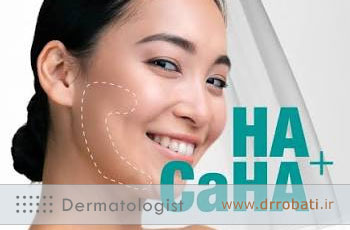 فیلر کلسیم هیدروکسی آپاتیت (CaHA) چیست؟ آشنایی با مهمترین فیلر بیواستیمولاتور
