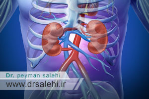 علت، علائم، تشخیص و درمان پیلونفریت