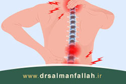 آرتروز کمر و ستون فقرات یا اسپوندیلوز (Spondylosis)