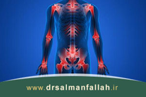 آرتروز مفاصل چیست؟