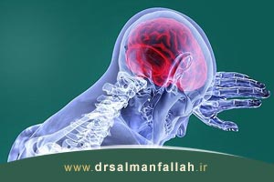 مونوپلژی چیست و چگونه بر بدن شما تأثیر میگذارد؟