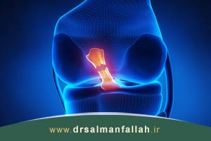 پارگی رباط صلیبی قدامی acl مفصل زانو