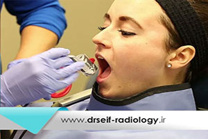 رادیوگرافی پری اپیکال یا تک دندان چیست؟