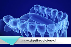 سونوگرافی نسج نرم در چه مواردی درخواست میشود؟