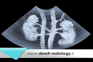 آنچه باید درباره سونوگرافی کلیه و مجاری ادراری بدانید