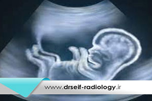 در بارداری چه سونوگرافی ضروری است؟