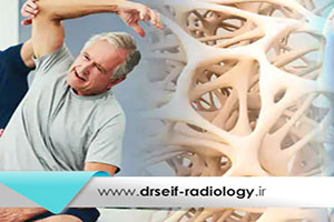 آیا با رادیولوژی میتوان سن استخوان را حدس زد؟