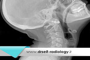 کاربردهای رادیولوژی دیجیتال DDR چیست؟