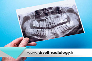 عکس پانورامیک دندان چه کاربردی دارد؟