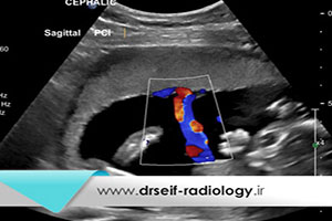 ضرورت انجام سونوگرافی داپلر در بارداری