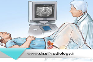 سونوگرافی ترانس رکتال پروستات چه کاربردی دارد؟
